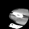 SPORK, NICO - 22.03.1976 - 02.08.2022 - CT obere Extremität - 17:51:17